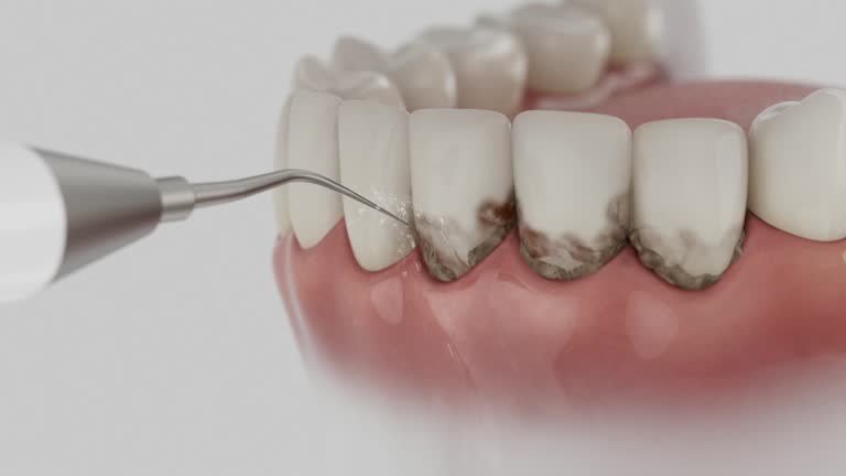 Reliable Emergency Dentist contractor in Eagle, CO by Smile Center Dentistry